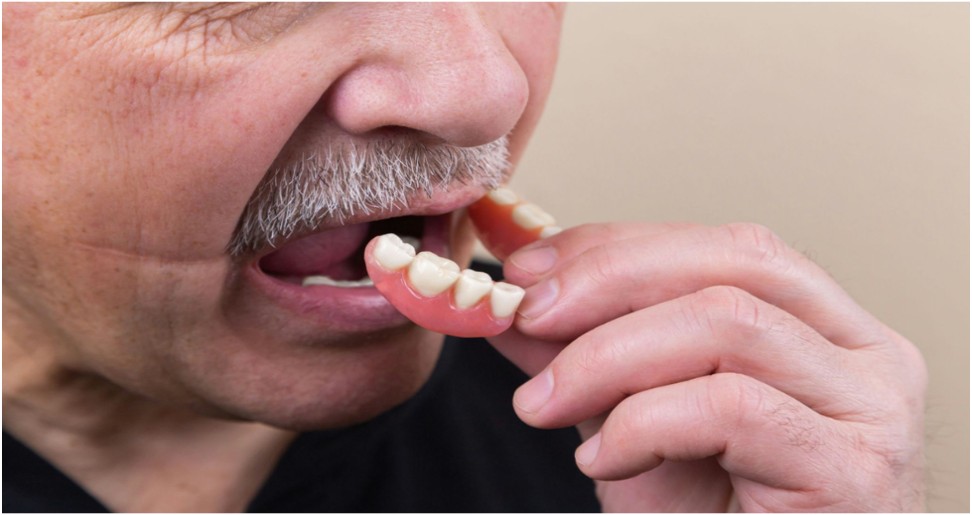 How Partial Dentures Can Restore Function and Confidence?